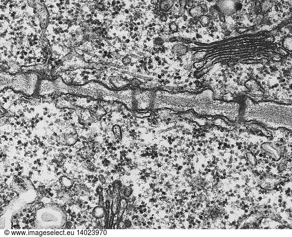 Plant Cell Wall Plant Cell Wall, Plasmodesmata (TEM),wall,cytoplasm ...