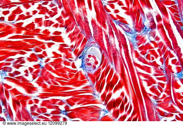 Pork Worm Larvae Trichinella Spiralis In A Muscular Tissue Optical Microscope X Pork Worm