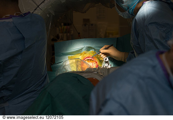 Reportage in the stereotactic neurosurgery operating theatre in Pasteur ...