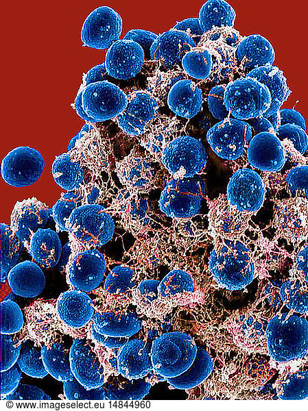 Scanning Electron Micrograph Of A Clump Of Staphylococcus Epidermidis