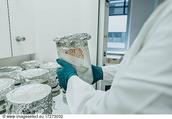 Scientist holding preserved human brain beaker while standing at laboratory