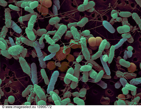 SEM of Bacteria from Dollar Bill SEM of Bacteria from Dollar Bill,agar ...