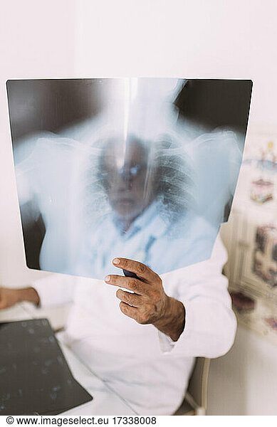 Senior male doctor examining x-ray at hospital