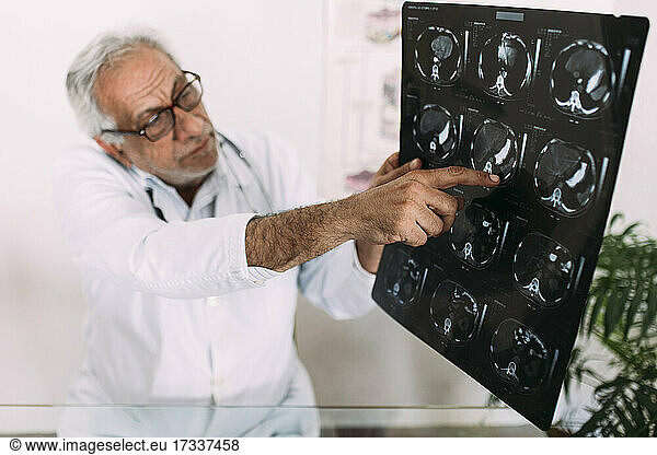 Senior male doctor explaining x-ray in hospital