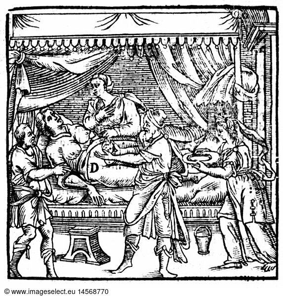 SG hist.  Medizin  Geburt / GynÃ¤kologie  Entbindung mittels Kaiserschnitt  Holzschnitt  aus: Scipione Mercurio  'La Comare o ricoglitrice'  Mailand  1618
