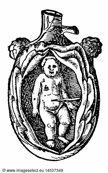 SG hist.  Medizin  Geburt / GynÃ¤kologie  Lage des Embryos im Mutterleib  Holzschnitt  aus: Jakob Ruf (1505 - 1558)  'TrostbÃ¼chlein'  Druck: Christoph Froschauer  ZÃ¼rich  1554
