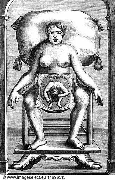 SG hist.  Medizin  Geburt / GynÃ¤kologie  schematische Darstellung einer Schwangeren mit Embryo in Geburtshaltung  Kupferstich  1766
