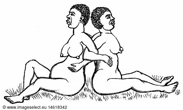 SG hist.  Medizin  Geburt / GynÃ¤kologie  Schwangere vom Stamm der Madi bei Entbindung mit Geburtshelferin  Zentralafrika  Zeichnung nach Robert Felkin (1853 - 1926)  um 1900