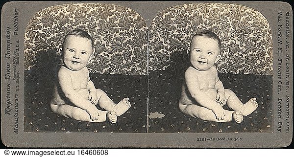 Singley  Benneville Lloyd 1864–1938.Group of 4 Stereograph Views of Babies  ca. 1850–1919.Albumen silver prints.Inv. Nr. 1982.1182.992–.995New York  Metropolitan Museum of Art.