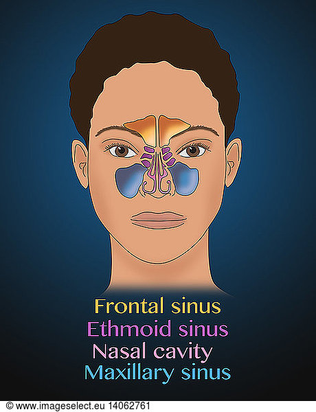 Sinus Anatomy Sinus Anatomy Illustrationnegroethmoidinfo Graphic Rights Managed 6190