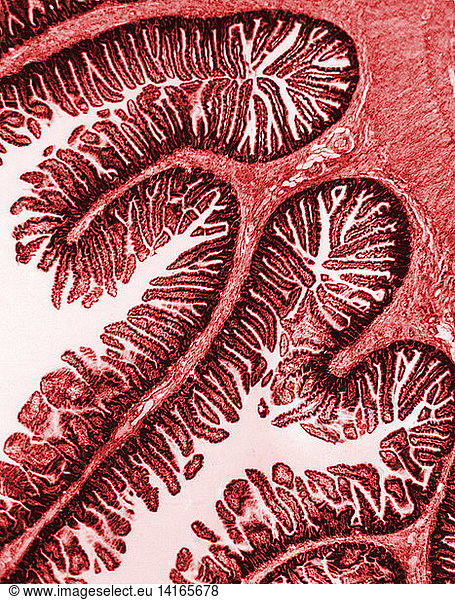 Small Intestine  Villi with Capillaries  TEM