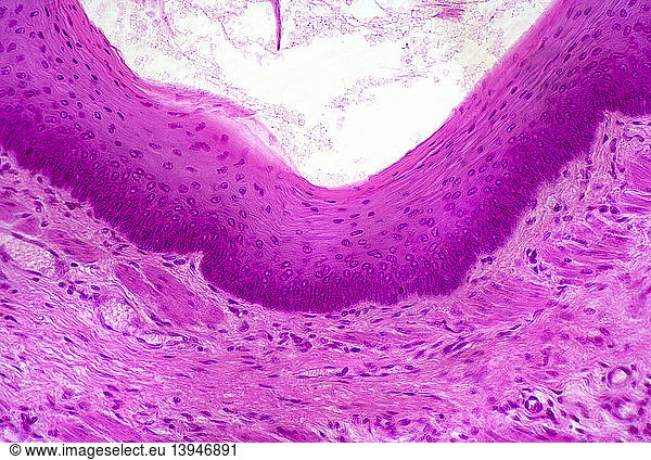 Stratified Squamous Epithelium Stratified Squamous Epithelium, Smooth ...