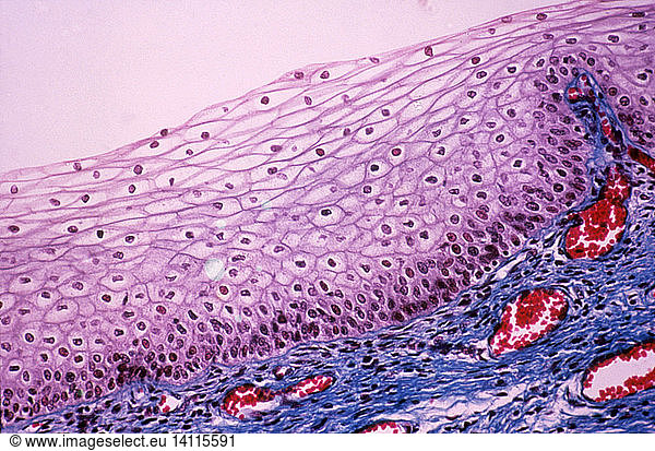 Stratified Squamous Epithelium Stratified Squamous Epithelium