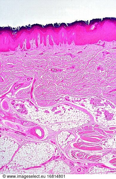 Stratified squamous epithelium from human hand skin showing keratinized epidermis and dermis with connective tissues. X25 at 10 cm wide.