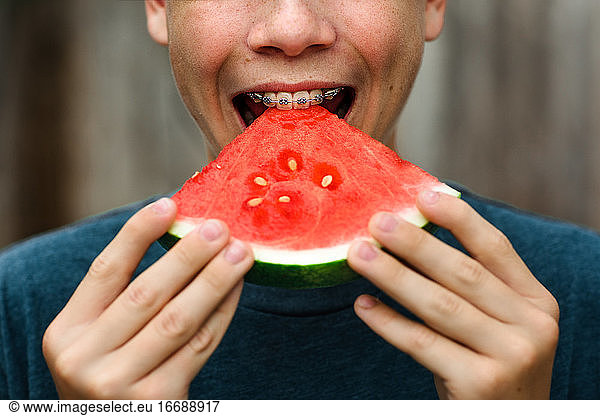 Teen boy with braces bites into watermelon
