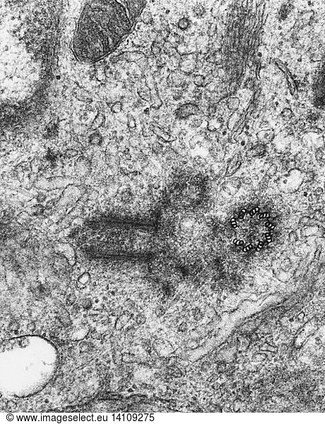 TEM of Centrosome TEM of Centrosome,centrosome,flagellar basal bodies ...