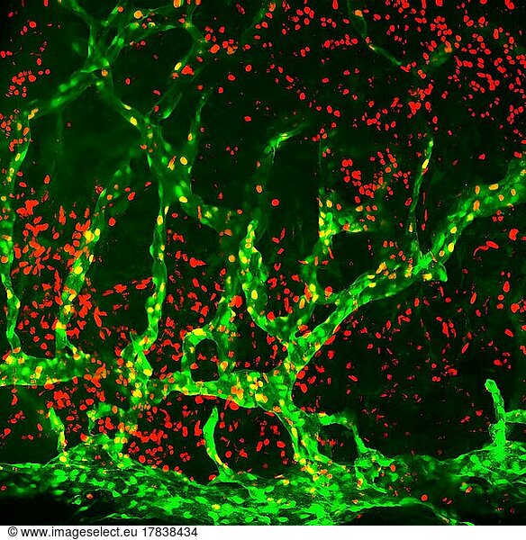 The galectin-8 pellet was deployed in the cornea of a Prox1-EGFP reporter mouse. On day 7 after implantation  the corneal flat mount was stained with an anti-Ki67 antibody. About 40% of lymphatic endothelial cells were proliferative (Prox1+Ki67+). Green: Prox1. Red: Ki67. Related publication: Pathologic lymphangiogenesis is modulated by galectin-8-dependent crosstalk between podoplanin and integrin-associated VEGFR-3. Communication Nature  2016.