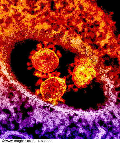 The round  pointed objects in the center of the image are MERS coronavirus particles.
