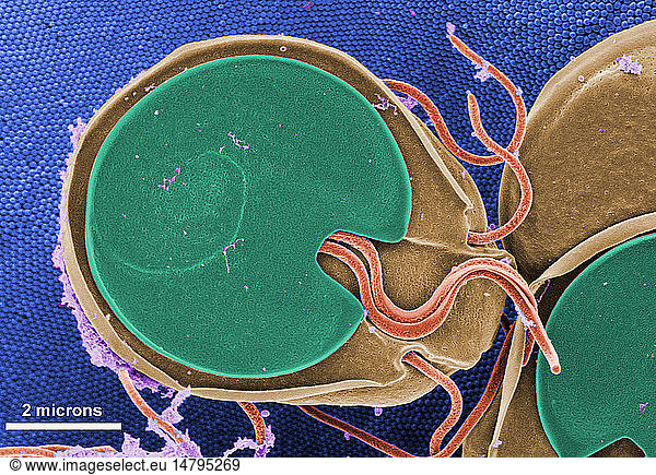 This scanning electron micrograph (SEM) revealed the ventral surface of a Giardia muris trophozoite that had settled atop the mucosal surface of a rats intestine. Note the microvilli  which can be seen in the background  as tiny rounded structures that are approximately 0.15 microns in diameter. These microvilli cover the surface of each intestinal epithelial cell. The Giardias ventral adhesive disk resembles a suction cup  where overlapping microtubules in the cytoplasm form a number-6-shaped figure. The edge of the suction cup  called the ventrolateral flange  partially encircles the adhesive disk and is absent posteriorly where a ventral pair of flagella emerges from above  dorsal to the disk. Giardia muris has four pairs of flagella that are responsible for the organisms motility. The adhesive disk facilitates adherence to the intestinal surface. The protozoan Giardia causes the diarrheal disease called giardiasis.