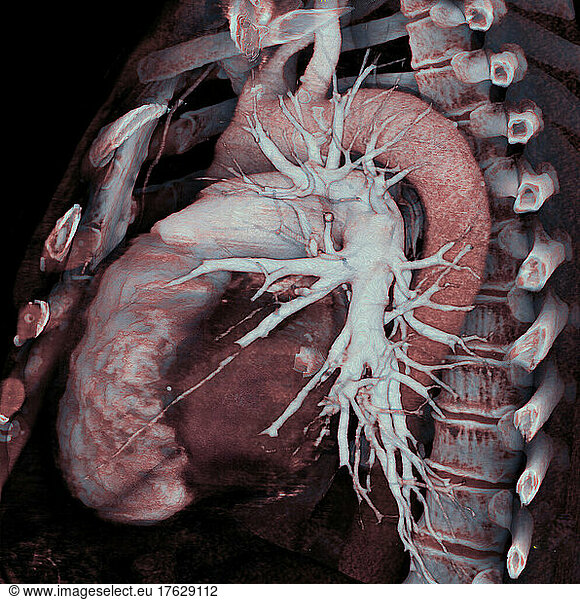 thorax-3d-ct-scan-thorax-3d-ct-scan-examinations-cardio-vascular