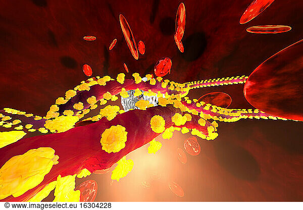 Three dimensional render of Ebola virus fighting with white blood cells in bloodstream
