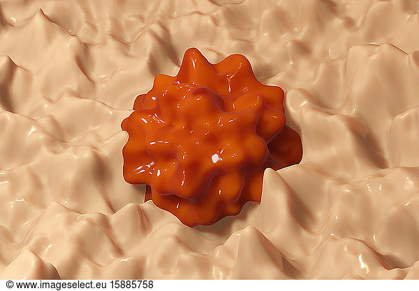 Three dimensional render of polyp growing on healthy tissue