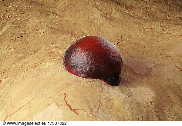 Three dimensional render of red germ entering human skin