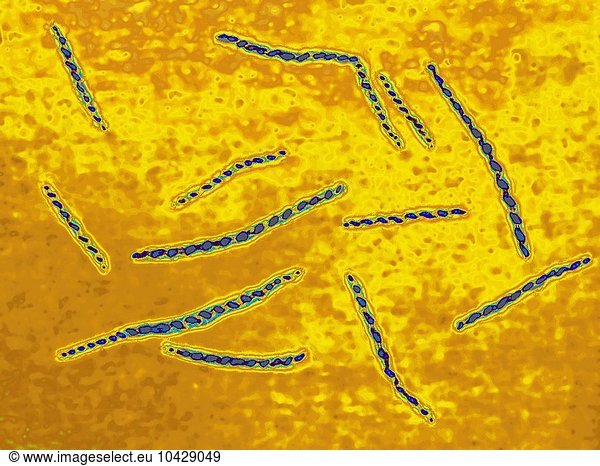 Treponema Pallidum Is The Bacterium That Causes Syphilis Treponema