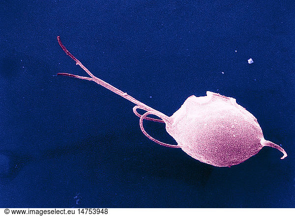 Trichomonas Vaginalis Trichomonas Vaginalis,bsip,ima,trichomonas 