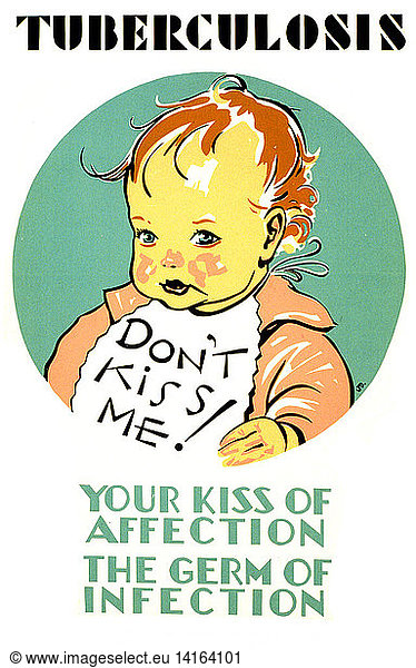 Tuberculosis  FAP Poster  1941