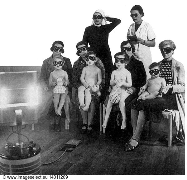 Ultraviolet Light Therapy to Prevent Rickets  1938