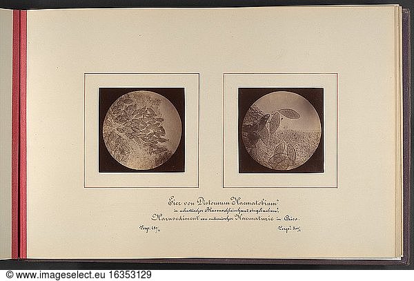 Ultzmann  Robert 1842–1889.Mikroskopisch-Photographischer Atlas der Harnsedimente  Micrograph  1869.Albumen silver prints.Inv. Nr. 2006.214New York  Metropolitan Museum of Art.