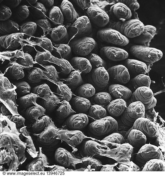 Villi From Mouse Small Intestine (SEM)