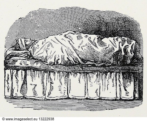 Wet Pack: Patient wrapped in cold  wet sheet for up to 60 minutes  patient then took a cold plunge. Used for many conditions from constipation to rheumatism. From ''Practical Hydropathy''  London  1863.