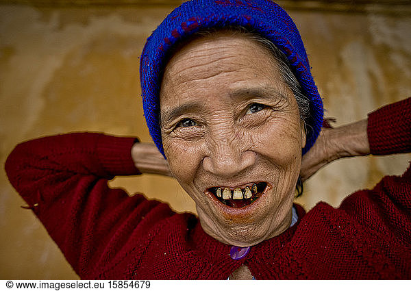 Woman with stained teeth due to betel nut usage