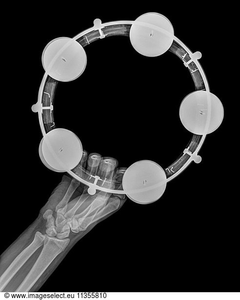 X-ray of a hand holding a tambourine