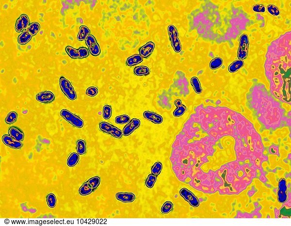 Yersinia pestis (Pasteurella pestis) is the bacterium responsible for ...