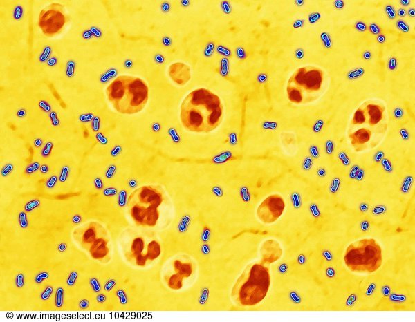 Yersinia pestis (Pasteurella pestis) is the bacterium responsible for ...