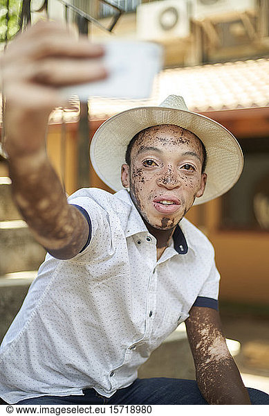 Young man with vitiligo using smartphone and taking a selfie