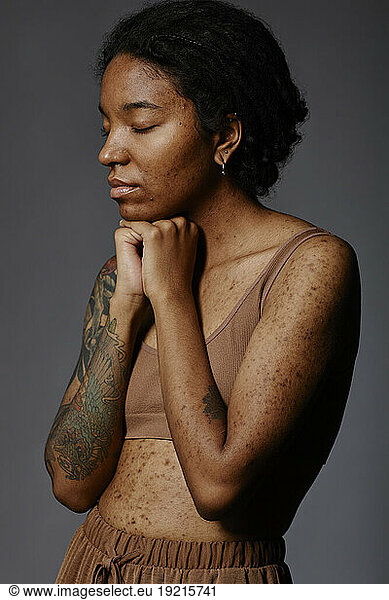 Young woman with acne scars and tattoo standing against gray background