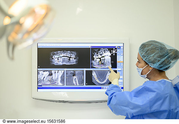 Zahnarzt Chirurg zeigt Implantat-Röntgenaufnahme