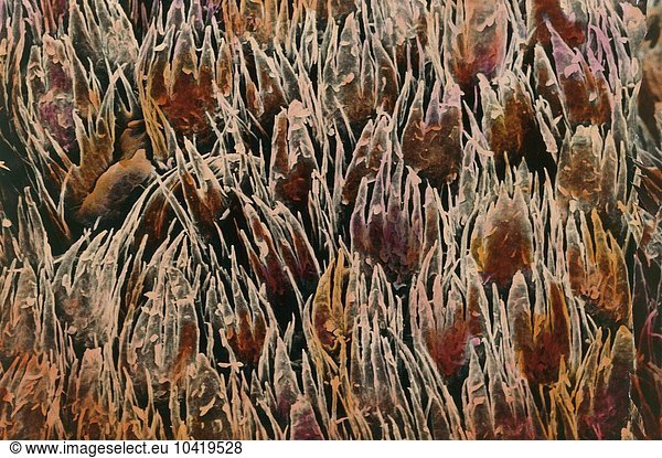 Zunge  Filiforme Papillen unter dem Mikroskop